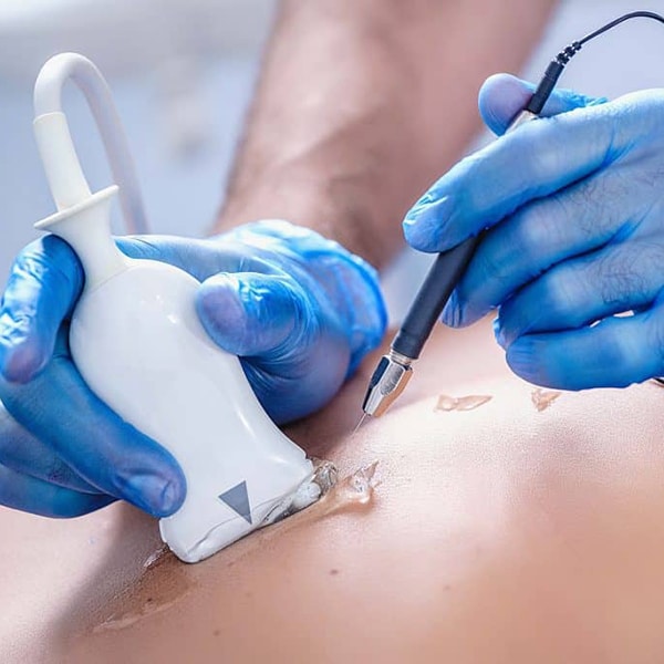 Electrolisis percutanea fisioterapia guadalajara